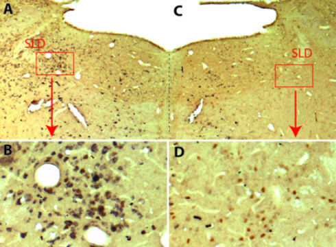 في الصورتين C و D: نشاهد الخلايا العصبية (باللون البني) عند فأر تجربة عالجه العلماء بالنواقل الفيروسية، ولكنها غير قادرة على إفراز مادة الغلوتامات glutamate (غياب اللون الأسود في الصورة) حقوق الصورة: Sara Valencia Garcia / Patrice Fort, (CNRS).