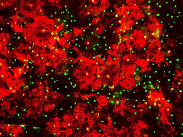 العديد من الخلايا الدبقية قليلة التغصنات Oligodendrocytes. حقوق الصورة: جامعة كوينز، بلفاست