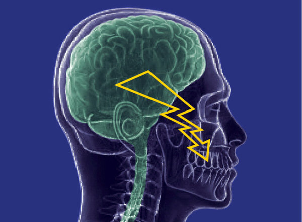 ألم العصب ثلاثي التوائم Trigeminal neuralgia: بريق أمل للمرضى بسبب مادة جديدة مختبرة. حقوق الصورة: Center of Dental Medicine; UZH}