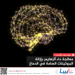 معالجة داء آلزهايمر بإزالة البروتينات السامة في الدماغ