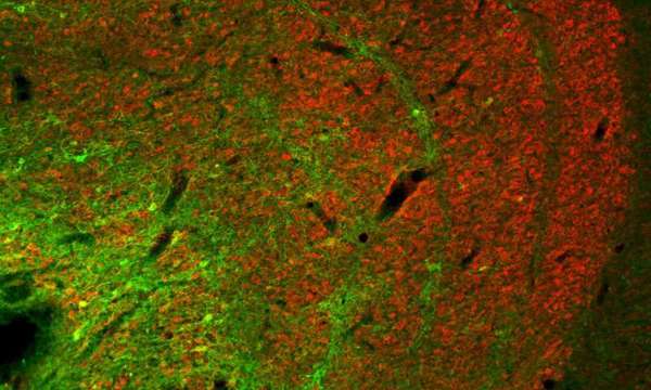 عصبونات كونيو (بالأخضر) في النواه الركبية الوحشية.  حقوق الصورة: معهد ماكس بلانك لعلوم التحكم الآلي الحيوية