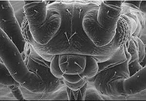 صورة بالمجهر الالكتروني لذبابة. Source: LEO Electron Microscopy Ltd, Image of a fly