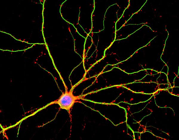 اكتشف علماء من UCLA أنّ التغصنات dendrites (وهي الموسومة باللون الأخضر في الصورة أعلاه) ليست مجرد مجاري عصبية مفعلة لنقل التيارات الكهربائية بين الخلايا العصبية.