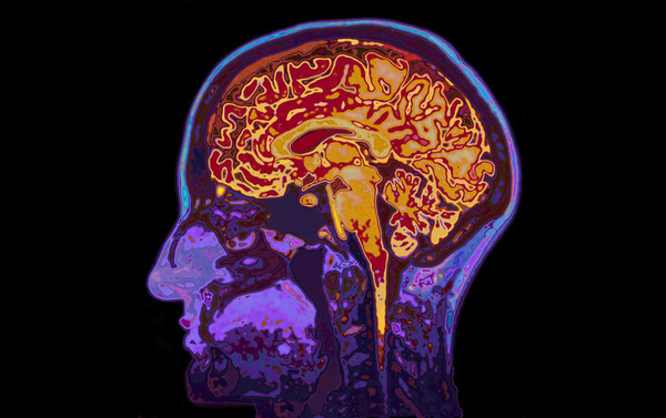 وجد باحثون اختلافات واسعة الانتشار في قشرة المخ كلها تقريبًا. حقوق الصورة: SpeedKingz/Shutterstock.com