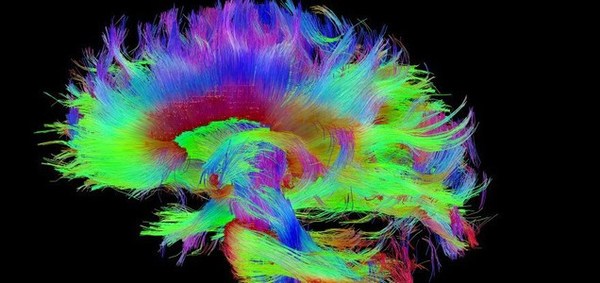 خريطة الدماغ البشري السليم