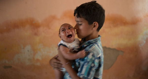 الجائحة تستمر، فتى برازيلي يحمل أخاه الصغير والمولود عام 2015 مع تشوُّه خلقي يدعى "ضمور الجمجمة microcephaly". يعتقد العلماء أنَّ هذه الحالة متصلة بإصابة الأم بعدوى فيروس زيكا Zika virus الذي ينتقل عن طريق البعوض