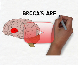علم الأعصاب خلال دقيقتين: باحة بروكا